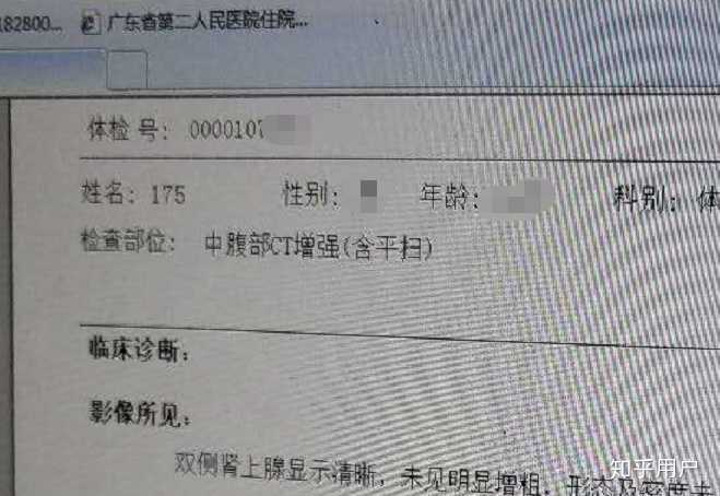 解读公务员体检标准，被刷情况分析与影响因素探讨